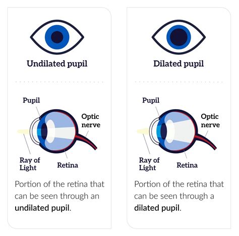 drops in eye to test eyes|dilating eyes side effects.